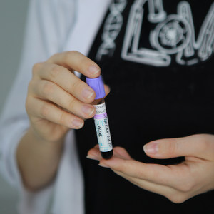 Scientists of Samara University Develop a Medical Product from Donated Blood Plasma